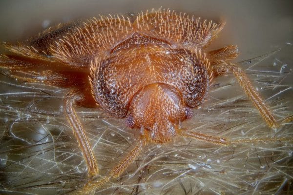 how do I get rid of fleas